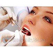 протезирование зубов,лечение зубов,удаление зубов. скидки 20%