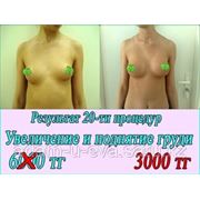 Подтянуть и увеличить грудь в Алматы