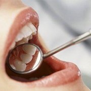 Стоматологические услуги в Киеве, услуги стоматолога, лечение зубов, обследование зубов фото
