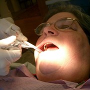 Эстетическая стоматология - Реставрация зубов фото