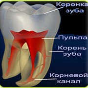 Лечение зубных каналов цена Киев. Лечим зубные каналы в Киеве. Лечение каналов зубов цена.Лечение каналов зуба. Лечения канала зуба фотография