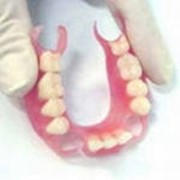 Протезирование зубов съемное в Алматы фото