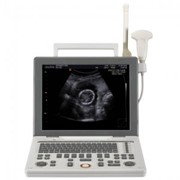 SonoAce R3 система диагностическая ультразвуковая портативная (Samsung Medison, Южная Корея) фото