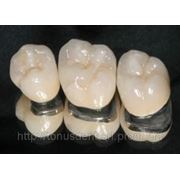 Protetica dentara. фото