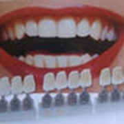 Протезирование зубов фото