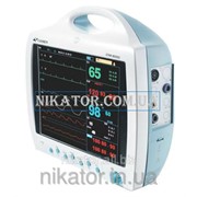 Монитор пациента Shenzhen STAR-8000С фотография