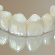 Протезирование зубов