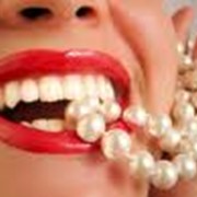 Лечение кариеса, некариозных поражений зубов Харьков фотография