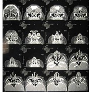 Магнитно-резонансная томография МРТ фото