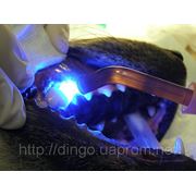 Восстановление зубов фотополимерным материалом фото