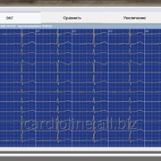 Программное обеспечение для снятия и анализа ЭКГ-покоя Cubeecg фото