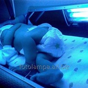 Прокат ЛАМПА для лечения ЖЕЛТУХИ у новорожденного фото