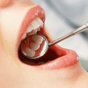 Наложение шва в пределах одного зуба