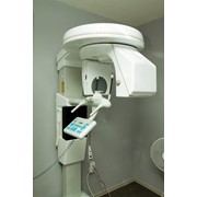 Ортопантомография (панорамная рентгенография)