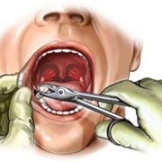 Хирургическая стоматология фотография
