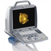 Ультразвуковой сканер и УЗИ аппарат CTS-7700 plus