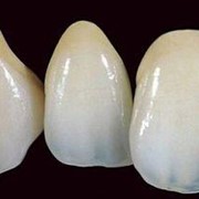 Зубные протезы из металлокерамики. Металлокерамика фото