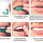 Отбеливание зубов.Стоматологический кабинет ТРИО фото