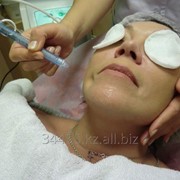 Услуга кислородного пилинга фото
