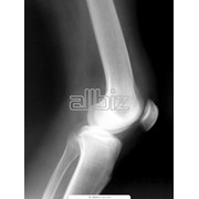 Лечение фото