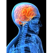Неврология — раздел медицины, занимающийся вопросами возникновения заболеваний центральной и периферической нервной системы, механизмы их развития, симптоматику и возможные способы диагностики, лечения и профилактики. фотография