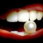 Химическое отбеливание зубов фото