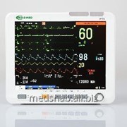 Монитор пациента iM15