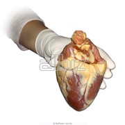 Аритмии сердца. фото