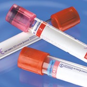 Пробирки для биохимии Vacutainer® фотография