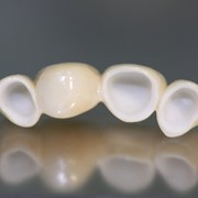 Удаление зуба простое фотография
