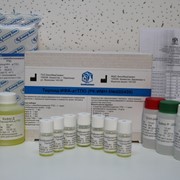 Набор реагентов для иммуноферментного определения аутоантител к тироидной пероксидазе в сыворотке крови Тироид-ИФА-атТПО фото