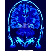 Компьютерная томография головного мозга фото