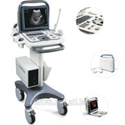 Ultrasonograf portativ A6, Sonoscape