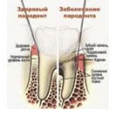 Лечение зубных каналов. Стоматологический кабинет ТРИО фото