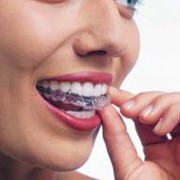 Отбеливание зубов! Виды и методы отбеливания зубов. фото