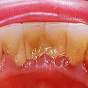 Стоматологические услуги фото