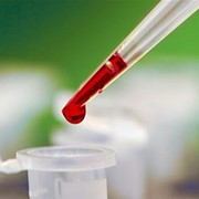 Анализы крови в клинике BioTexCom