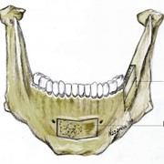 Исправление прикуса и патологий зубо-челюстной системы