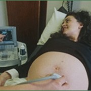 Ведение беременности фотография