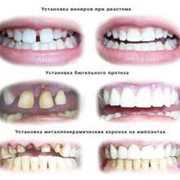 Протезирование зубов. Стоматологический кабинет ТРИО фото