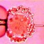 Инъекция сперматозоида в яйцеклетку фото