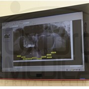 Рентгенография, Рентген стоматологический в Киеве, цена фотография