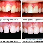 Реставрационная стоматология