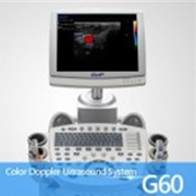 Сканер ультразвуковой полностью цифровой с цветовым доплером G60 / EMP 3000 фото