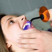 Пломбирование зубов фото