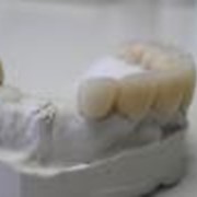 Зуб пластмассовый временный фото