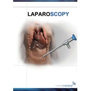 Инструмент для лапароскопии фото