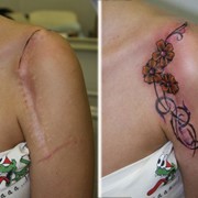Татуировки на шрамах