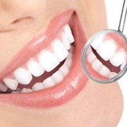 Удаление зубного камня в Киеве Клиника Ортолайф, профессиональная гигиена, чистка зубов