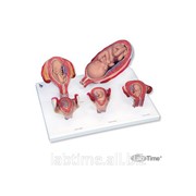 Набор из 5 моделей Стадии беременности 3B Scientific® 1000331 фотография